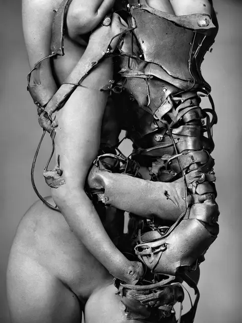 Thoracic Orthosis 02 by Iñigo Bilbao