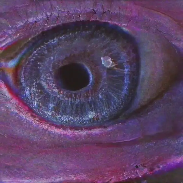 Optic Nerve 03 by Katie Morris