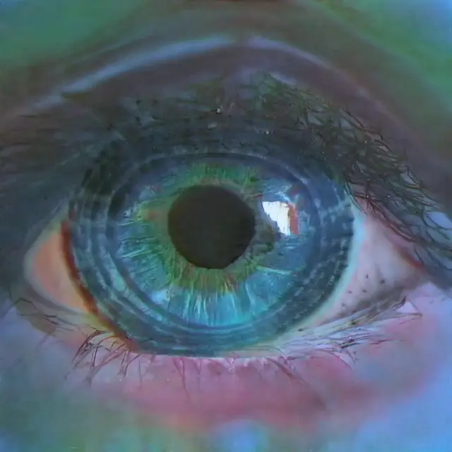 Optic Nerve 02 (Katie Morris) by Katie Morris