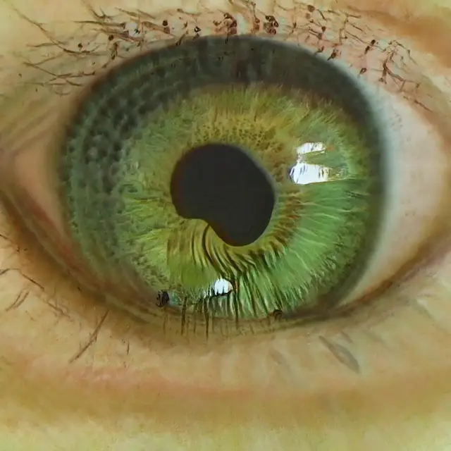 Optic Nerve 01 (Katie Morris) by Katie Morris