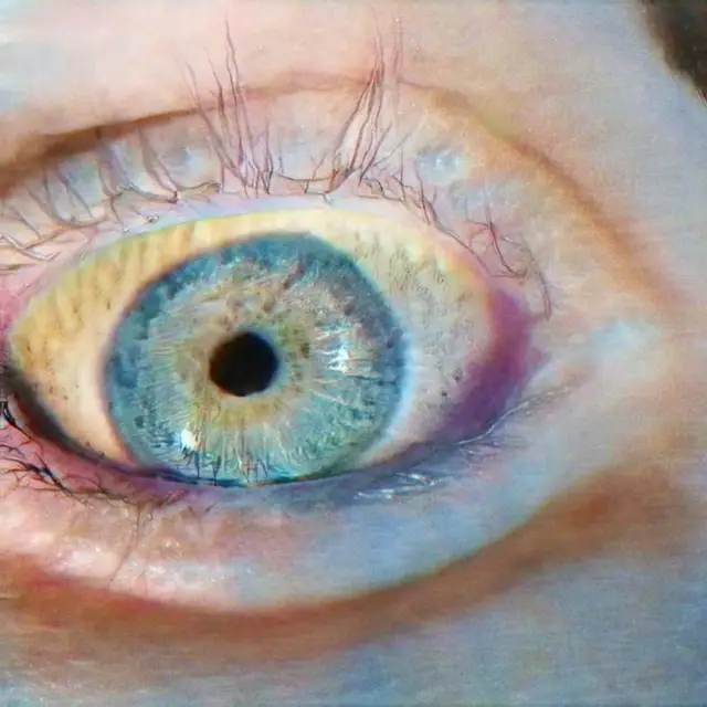 Optic Nerve 05 by Katie Morris