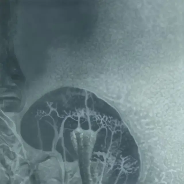Portal Meditation 4 “Blur of possibilities” by Domingo Pablo