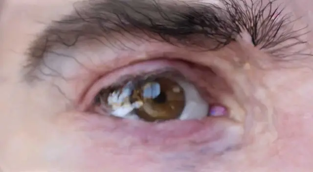 Eye 6 - Registering (Milo Poelman) by Milo Poelman